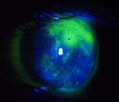 Eye_GA201093
