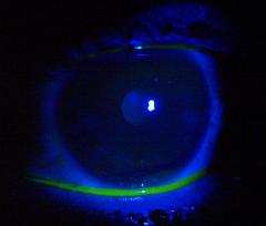 Eye_GA201094